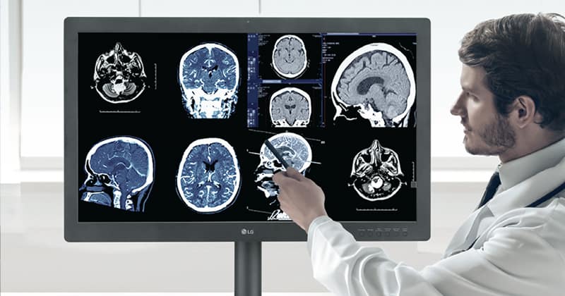 LG diagnostic monitor on display