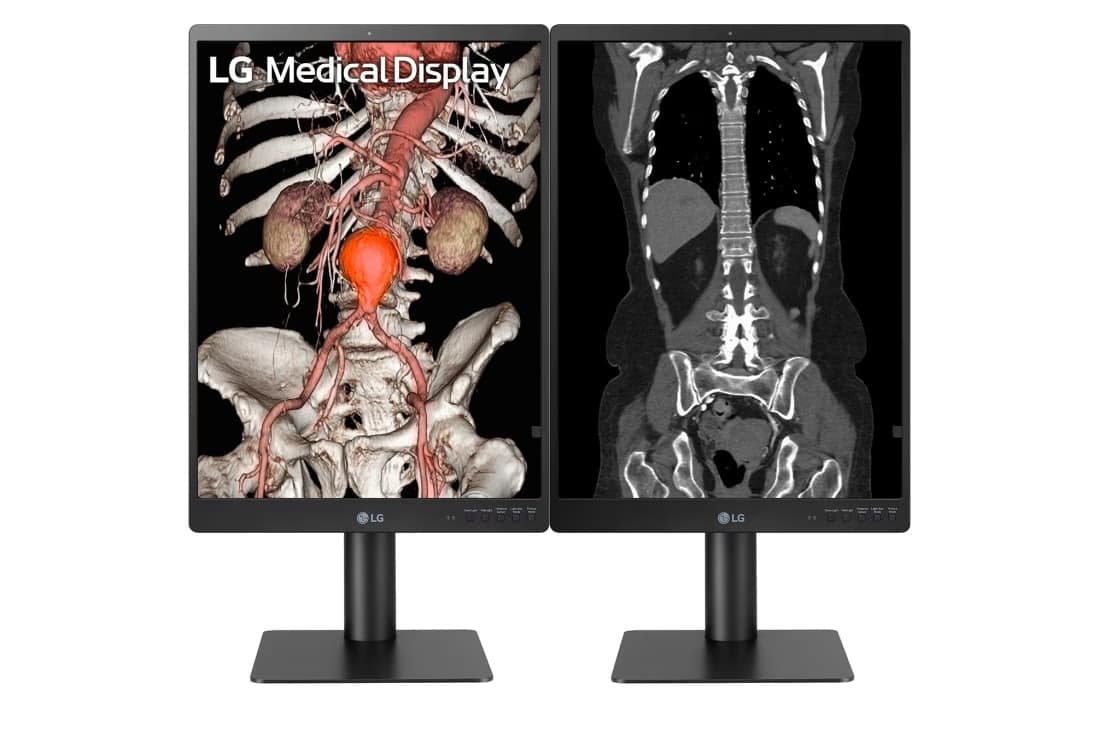 LG 21HQ513D-B Medical Monitor - Multi-Port Connectivity Detail