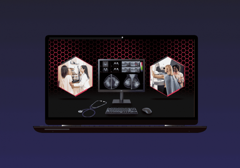 Mammography
