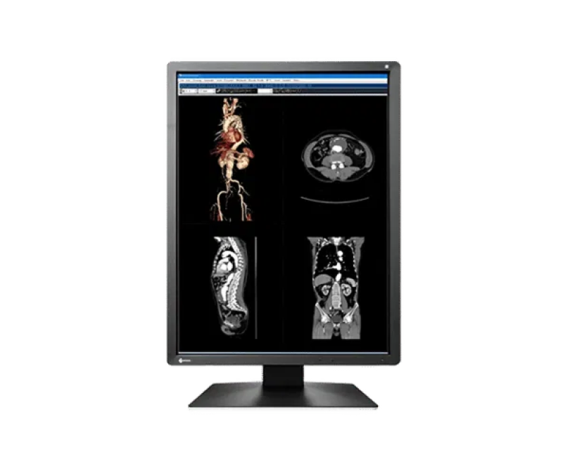 EIZO RadiForce MX216 — 21.3″ 2MP Medical Monitor
